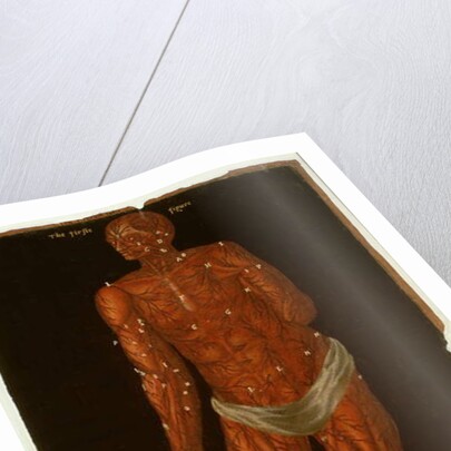 Ms Hunter 364 Table XI Dissection by English School