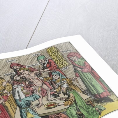 Circumcision by German School