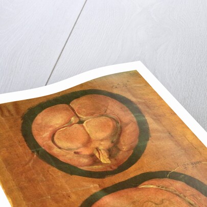 Anatomical drawing of the human brain by Hieronymus Fabricius ab Aquapendente