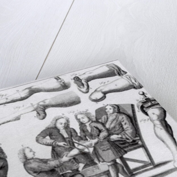 Surgical operations on limbs by English School