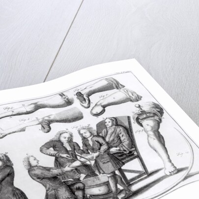 Surgical operations on limbs by English School