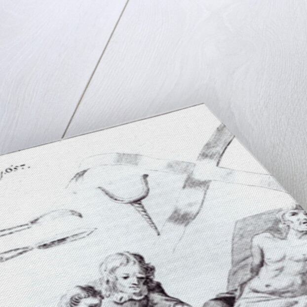 Surgical operation to amputate a leg by English School