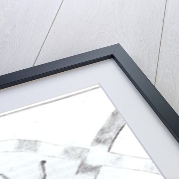 Surgical operation to amputate a leg by English School