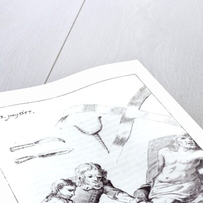 Surgical operation to amputate a leg by English School