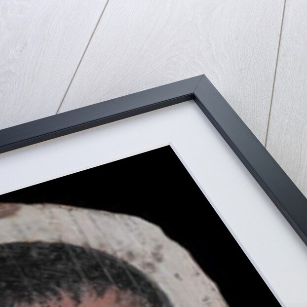 Portrait of a Youth with a Surgical Cut in one Eye, 190-210 AD by Roman Period Egyptian