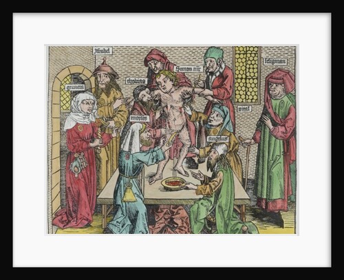 Circumcision by German School