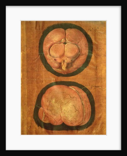 Anatomical drawing of the human brain by Hieronymus Fabricius ab Aquapendente