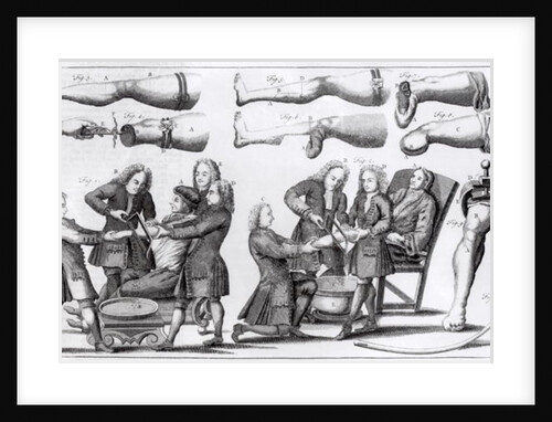 Surgical operations on limbs by English School