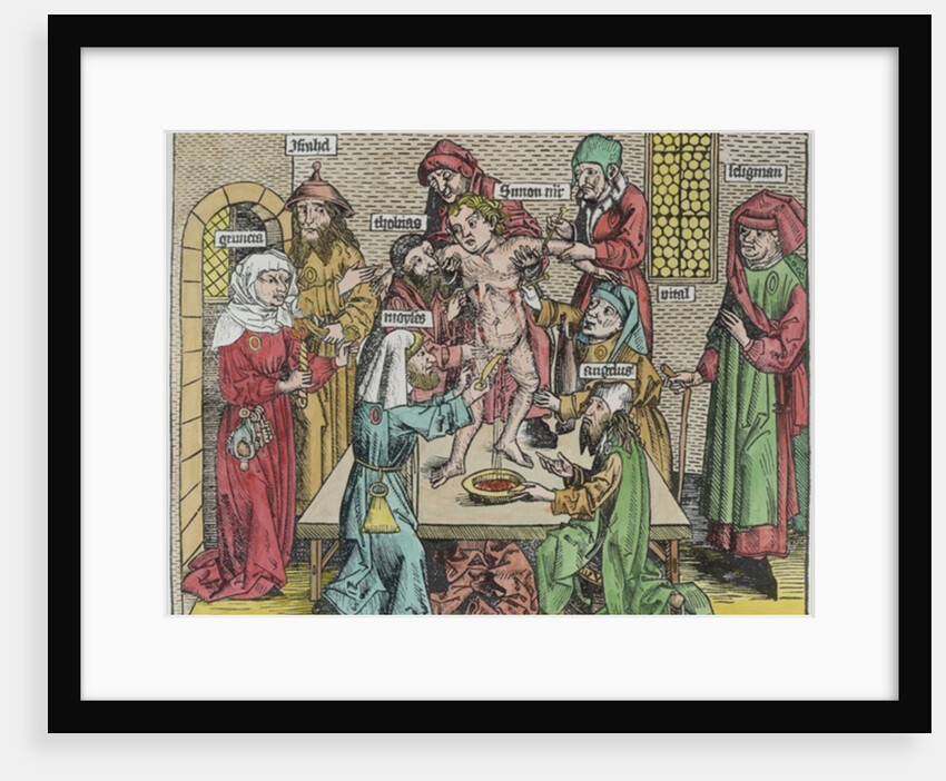 Circumcision by German School