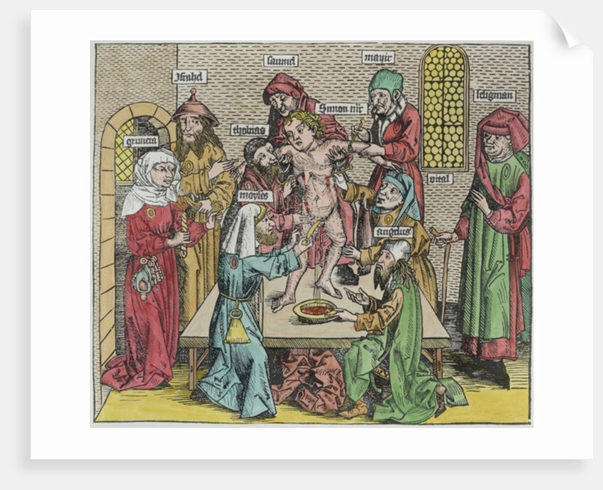 Circumcision by German School