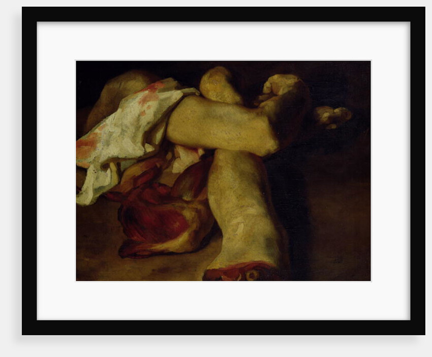 Anatomical Pieces by Theodore Gericault