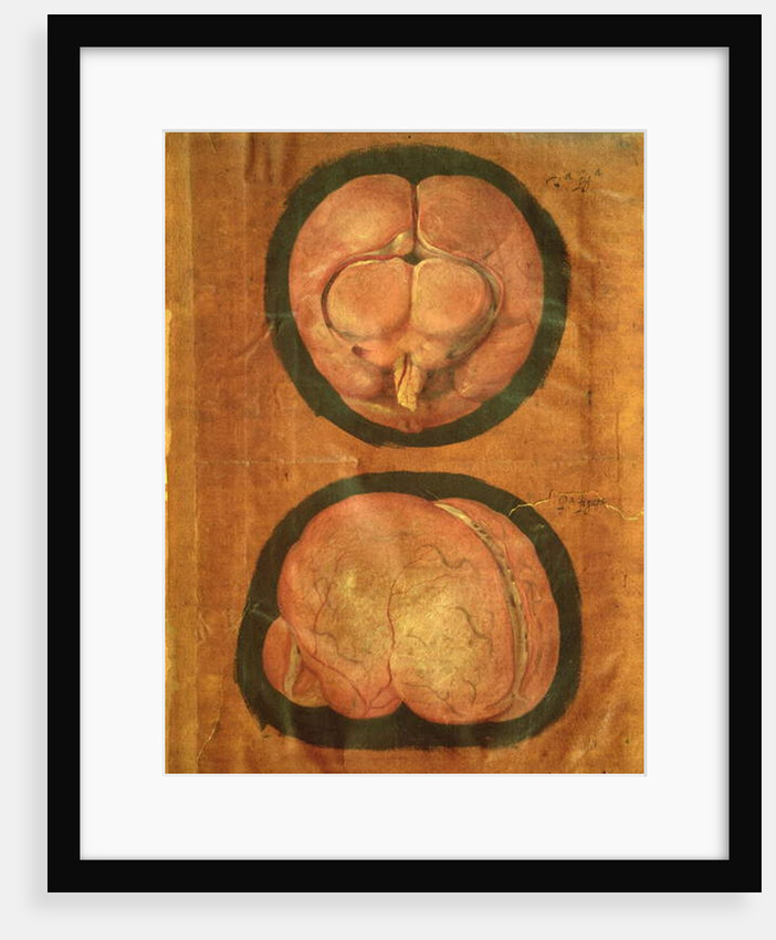 Anatomical drawing of the human brain by Hieronymus Fabricius ab Aquapendente