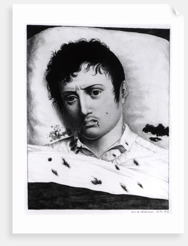 Observation of Yellow Fever, c.1819 by Charles Lasteyrie du Saillant