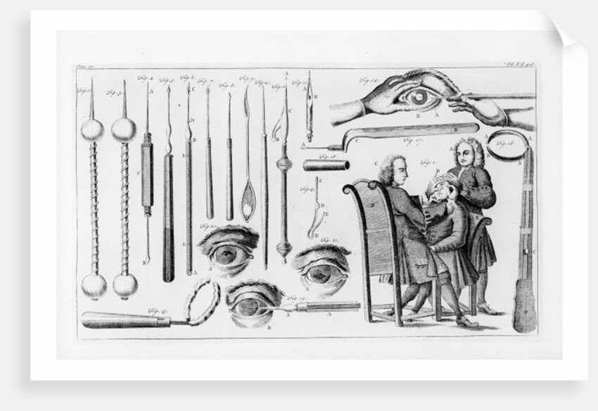 Medical instruments for eye surgery by English School