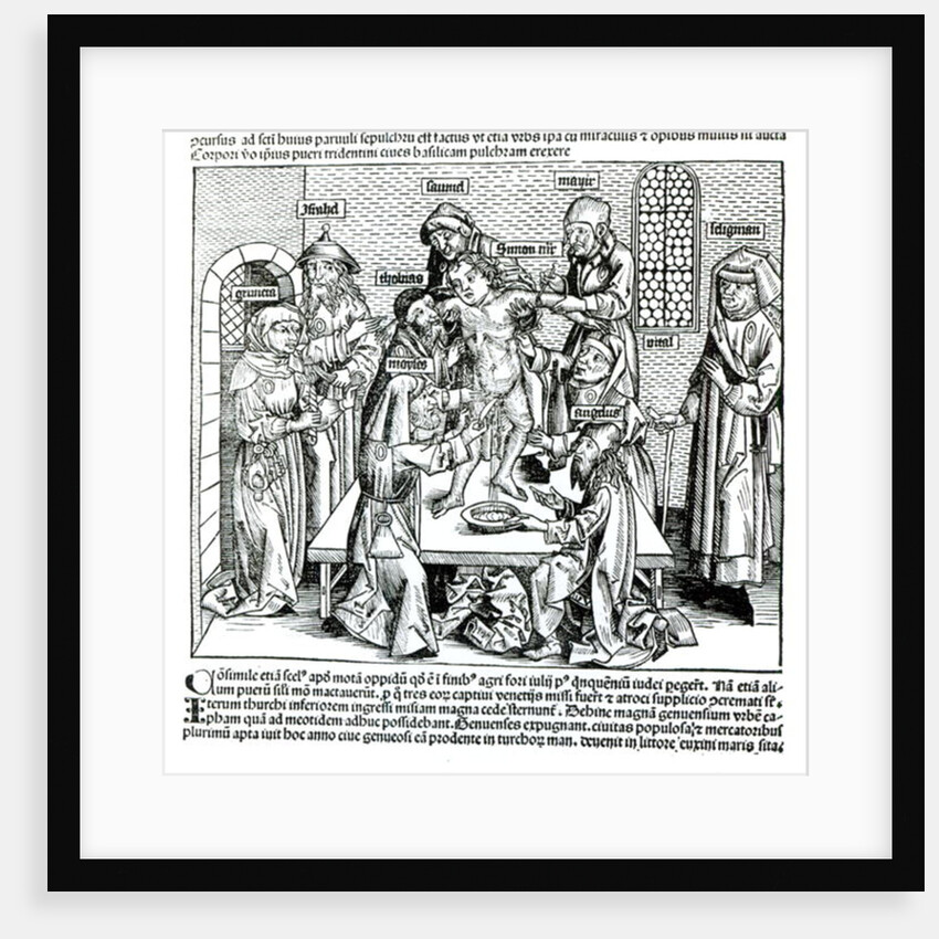 Circumcision by German School