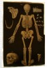 Ms Hunter 364 Table IV, from Anatomical Tables, by John Banister by English School