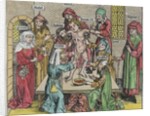 Circumcision by German School