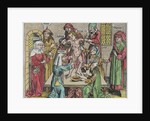 Circumcision by German School