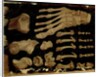 Anatomical drawing of the bones of the foot by Hieronymus Fabricius ab Aquapendente