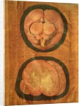Anatomical drawing of the human brain by Hieronymus Fabricius ab Aquapendente
