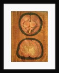 Anatomical drawing of the human brain by Hieronymus Fabricius ab Aquapendente