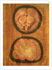 Anatomical drawing of the human brain by Hieronymus Fabricius ab Aquapendente