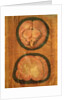 Anatomical drawing of the human brain by Hieronymus Fabricius ab Aquapendente