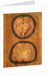 Anatomical drawing of the human brain by Hieronymus Fabricius ab Aquapendente