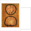 Anatomical drawing of the human brain by Hieronymus Fabricius ab Aquapendente