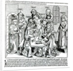 Circumcision by German School