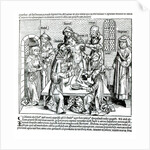 Circumcision by German School