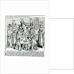 Circumcision by German School