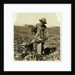 Alex Reiber aged 7 carries on topping sugar beets after 'hooking' his knee, near Sterling, Colorado, 1915 by Lewis Wickes Hine