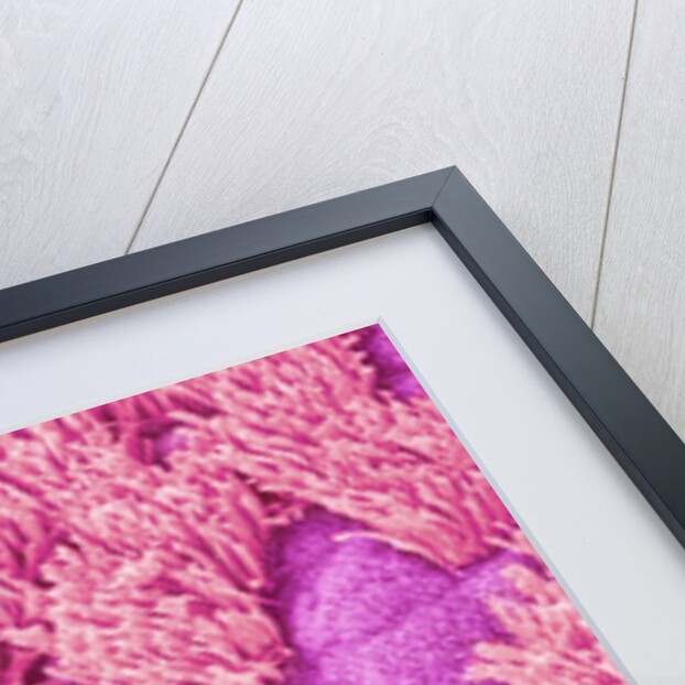 Trachea of a Rat by Anonymous
