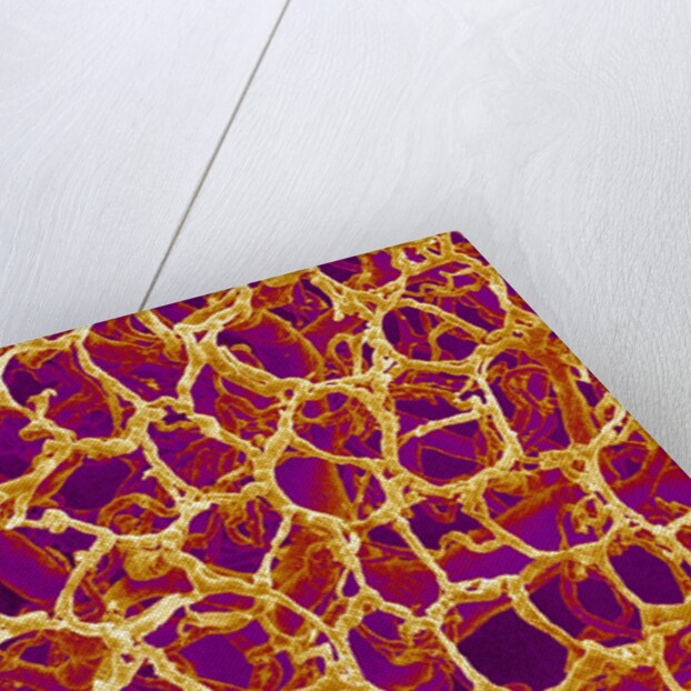 Blood Vessel Cast from Colon of a Rat by Anonymous