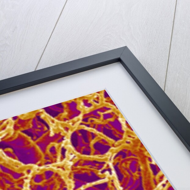 Blood Vessel Cast from Colon of a Rat by Anonymous