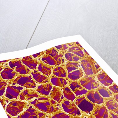 Blood Vessel Cast from Colon of a Rat by Anonymous