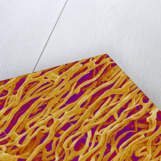 Blood Vessel Cast in Heart of a Rat by Anonymous