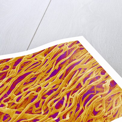 Blood Vessel Cast in Heart of a Rat by Anonymous