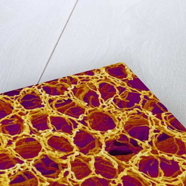 Blood Vessel Cast from Stomach of a Rat by Anonymous