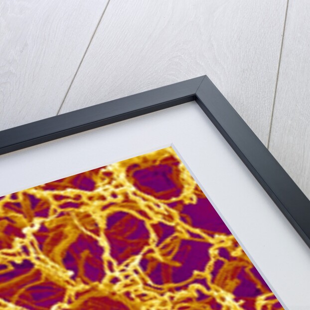 Blood Vessel Cast from Stomach of a Rat by Anonymous