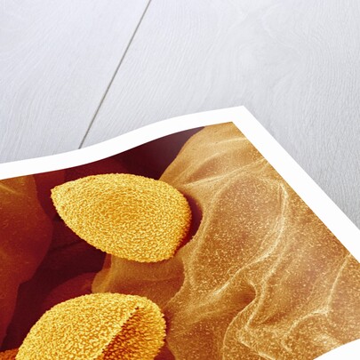 Spores of a Flowering Fern by Anonymous