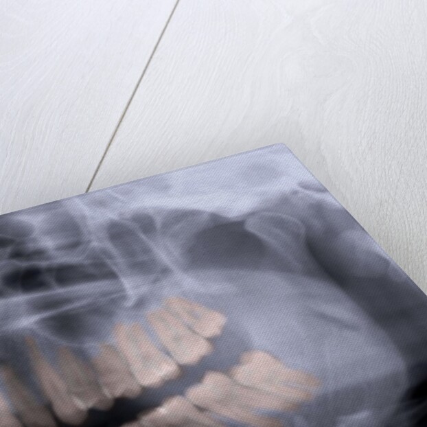 Panoramic X-Ray of Mouth by Anonymous