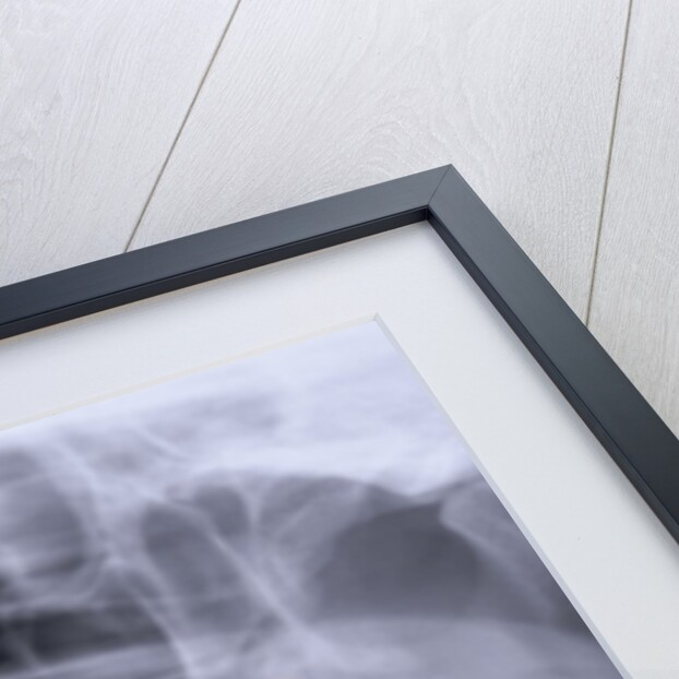 Panoramic X-Ray of Mouth by Anonymous