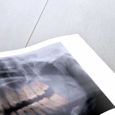 Panoramic X-Ray of Mouth by Anonymous