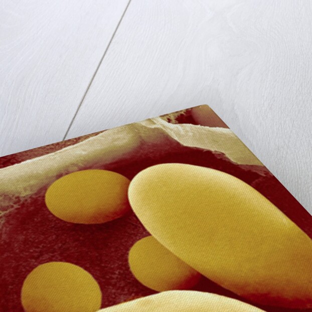 Starch Grains of Potato Cells by Anonymous