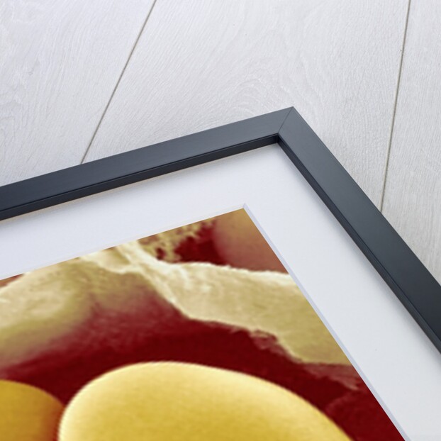Starch Grains of Potato Cells by Anonymous