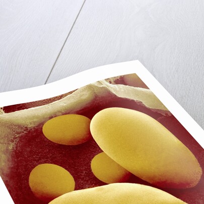 Starch Grains of Potato Cells by Anonymous
