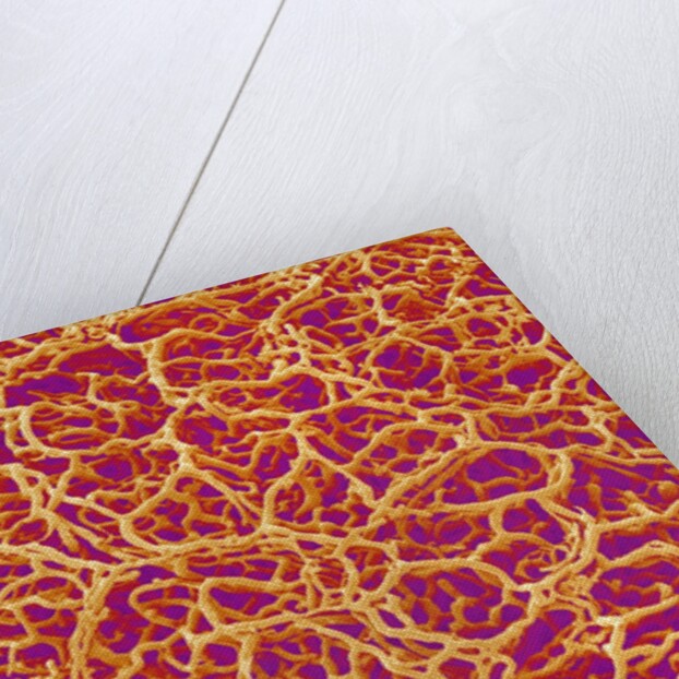 Blood Vessel Cast from Rat Colon by Anonymous