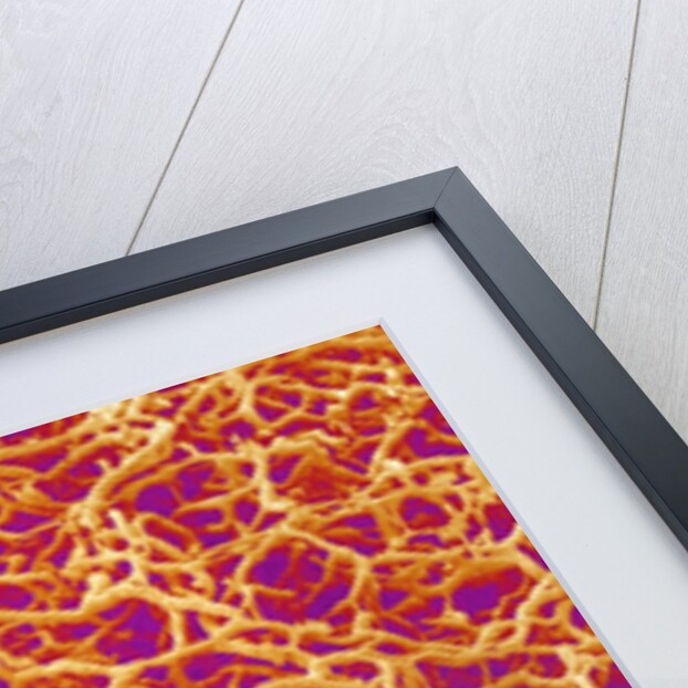 Blood Vessel Cast from Rat Colon by Anonymous